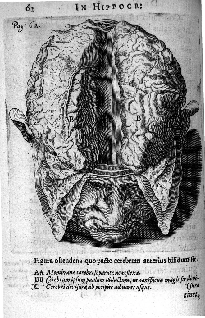 An illustration from Petri Paaw Amsteldamensis Succenturiatus Anatomicus. continens Commentaria in Hippocratem, de Capitis Vulneribus. additae In aliquot Capita libri VIII C. Celsi Explicationes. Ad illustres, Nobiles, Praepotentes, ac verè Magnifices Hollandiae Westfrisiaeque Ordines., 1616, leaf 71
