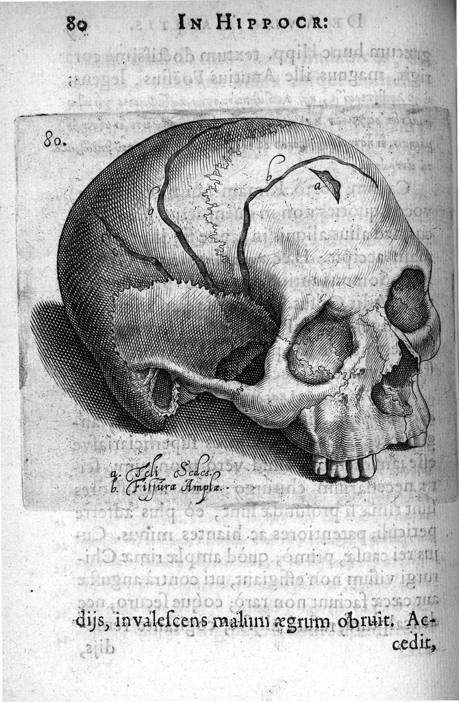 An illustration from Petri Paaw Amsteldamensis Succenturiatus Anatomicus. continens Commentaria in Hippocratem, de Capitis Vulneribus. additae In aliquot Capita libri VIII C. Celsi Explicationes. Ad illustres, Nobiles, Praepotentes, ac verè Magnifices Hollandiae Westfrisiaeque Ordines., 1616, leaf 89