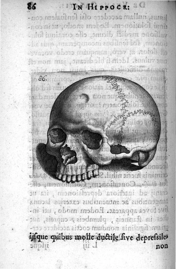 An illustration from Petri Paaw Amsteldamensis Succenturiatus Anatomicus. continens Commentaria in Hippocratem, de Capitis Vulneribus. additae In aliquot Capita libri VIII C. Celsi Explicationes. Ad illustres, Nobiles, Praepotentes, ac verè Magnifices Hollandiae Westfrisiaeque Ordines., 1616, leaf 95