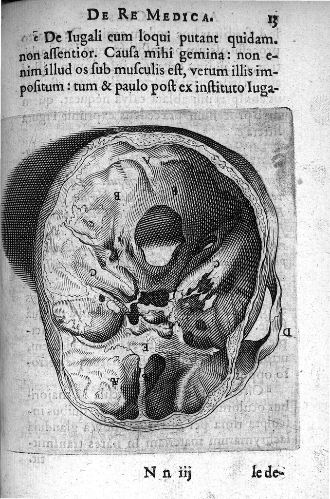 An illustration from A. Cornelii Celsi de Re Medica liber octavus. ejus priora quatuor Capita Commentariis illustrata a Petro Paaw, 1616, leaf 14