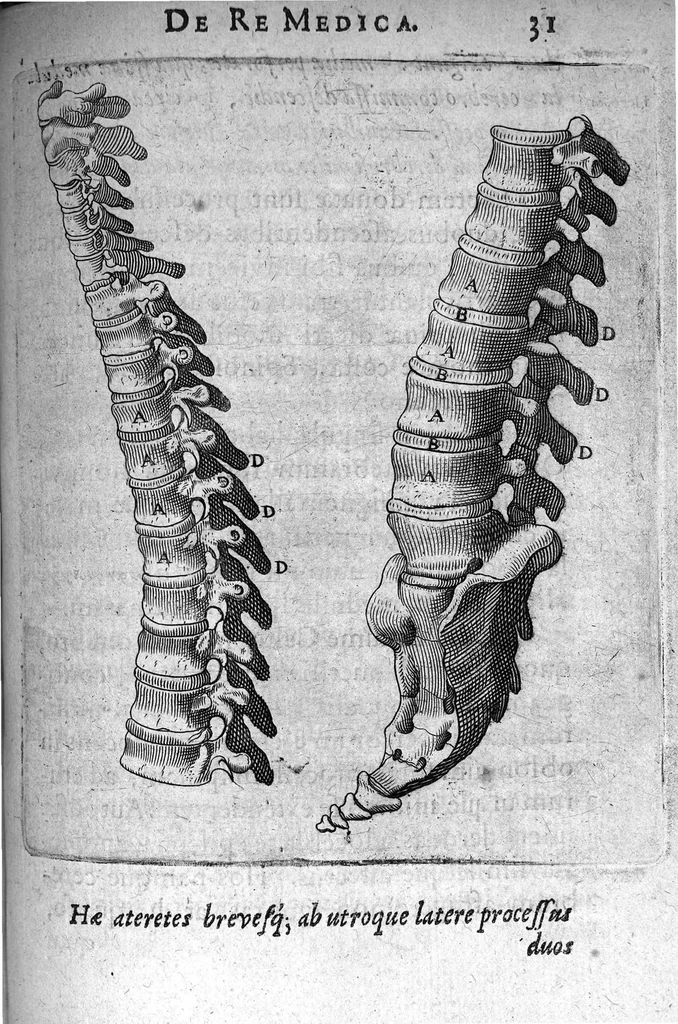 An illustration from A. Cornelii Celsi de Re Medica liber octavus. ejus priora quatuor Capita Commentariis illustrata a Petro Paaw, 1616, leaf 32