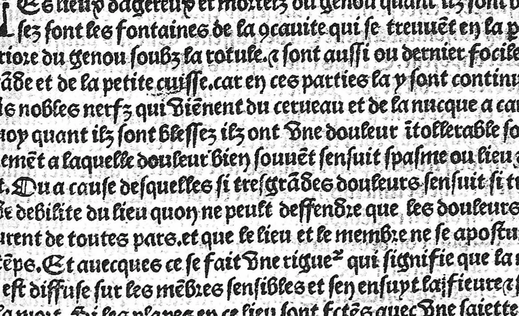 An illustration from La cyrurgie de maistre Guillaume de Salicet, 1505, leaf 150