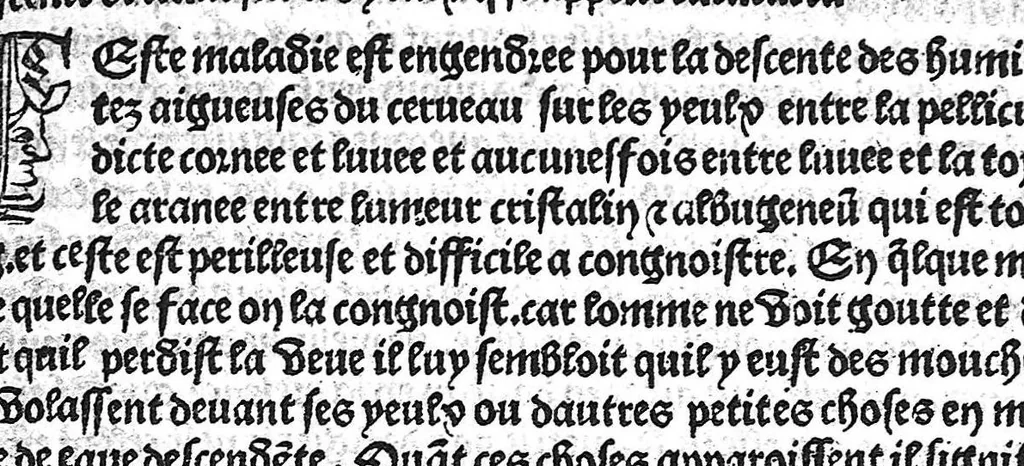 An illustration from La cyrurgie de maistre Guillaume de Salicet, 1505, leaf 20