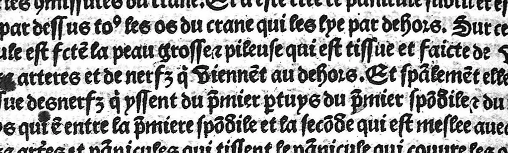An illustration from La cyrurgie de maistre Guillaume de Salicet, 1505, leaf 215