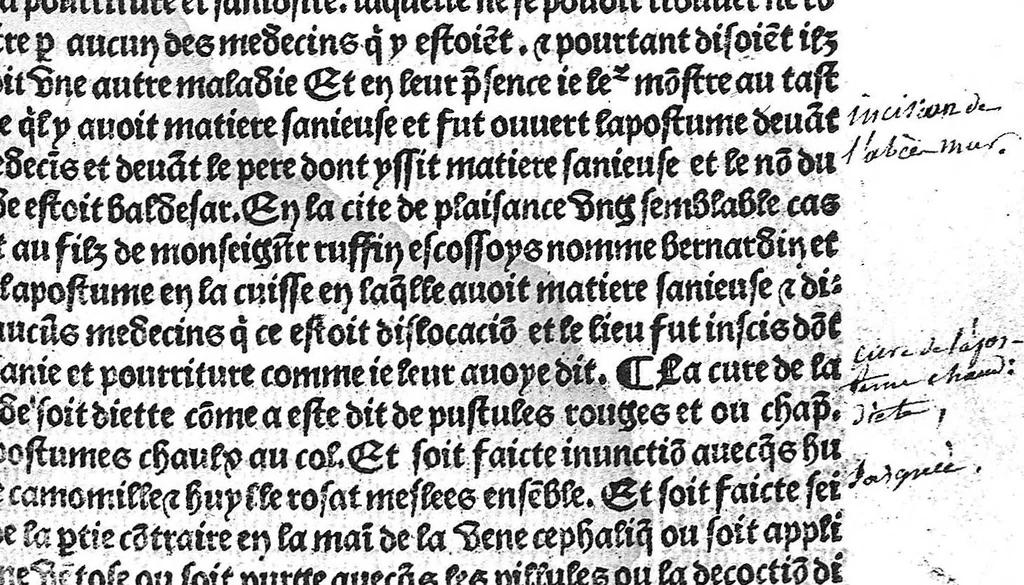An illustration from La cyrurgie de maistre Guillaume de Salicet, 1505, leaf 44
