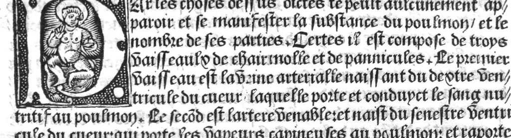 An illustration from Cy est Lanathomie de maistre Mundin boullonnoys, naguere traduicte de langue latine en vulgaire ou francoyse. Ou sont plusieurs figures et apostilles : moult requise et necessaire pour la congnoissance et notice dicelle/ Reveue et recongneue en plusieurs lieus par ledit translateur. Nouvellement imprimée, 1532, leaf 69