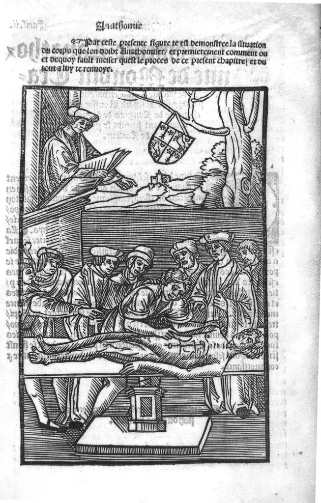 An illustration from Cy est Lanathomie de maistre Mundin boullonnoys, naguere traduicte de langue latine en vulgaire ou francoyse. Ou sont plusieurs figures et apostilles : moult requise et necessaire pour la congnoissance et notice dicelle/ Reveue et recongneue en plusieurs lieus par ledit translateur. Nouvellement imprimée, 1532, leaf 9