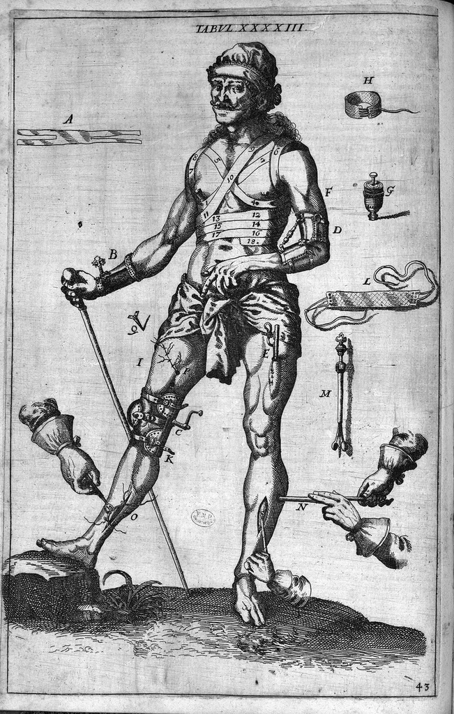 An illustration from Cheiroplotheke, seu... Armamentarium chirurgicum XLIII tabulis... exornatum. Opus posthumum..., 1655, leaf 137