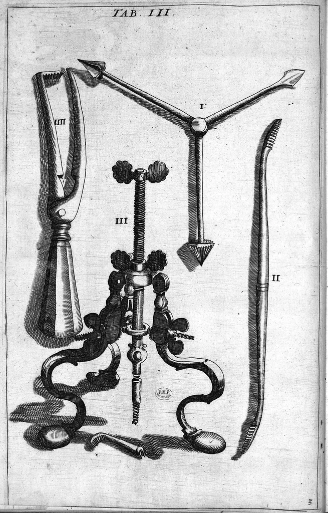 An illustration from Cheiroplotheke, seu... Armamentarium chirurgicum XLIII tabulis... exornatum. Opus posthumum..., 1655, leaf 17