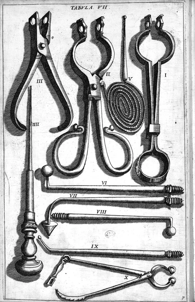 An illustration from Cheiroplotheke, seu... Armamentarium chirurgicum XLIII tabulis... exornatum. Opus posthumum..., 1655, leaf 25