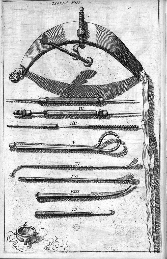 An illustration from Cheiroplotheke, seu... Armamentarium chirurgicum XLIII tabulis... exornatum. Opus posthumum..., 1655, leaf 27