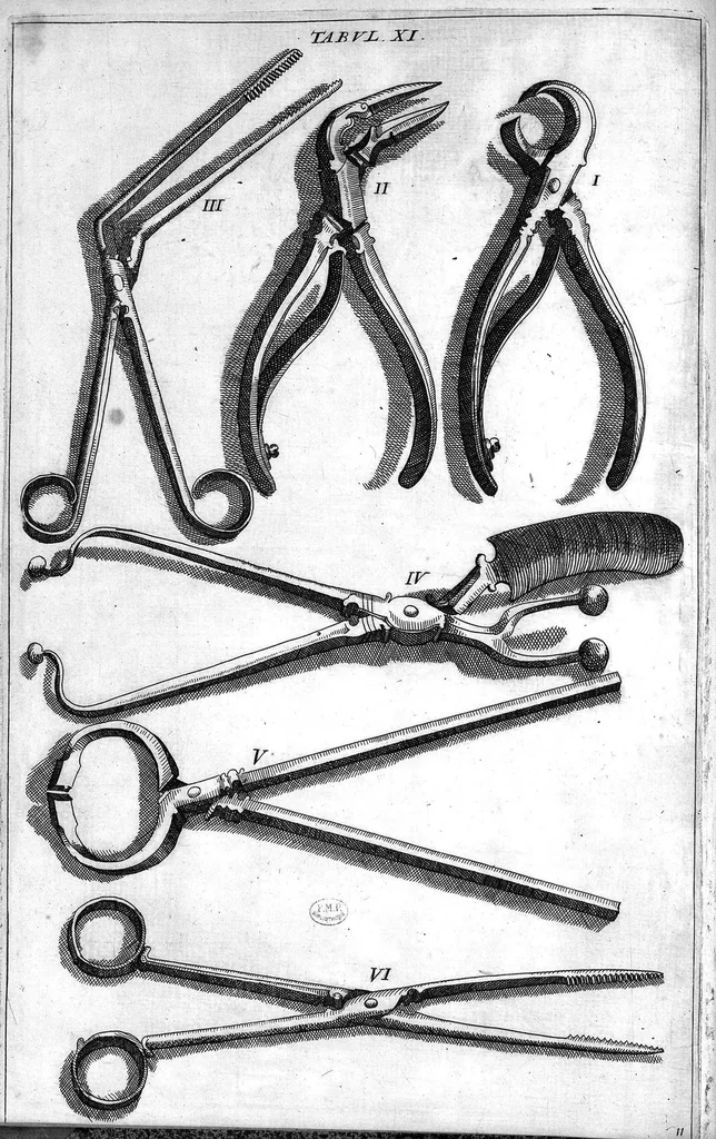 An illustration from Cheiroplotheke, seu... Armamentarium chirurgicum XLIII tabulis... exornatum. Opus posthumum..., 1655, leaf 33