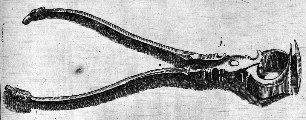 An illustration from Cheiroplotheke, seu... Armamentarium chirurgicum XLIII tabulis... exornatum. Opus posthumum..., 1655, leaf 52