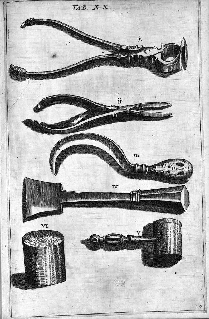 An illustration from Cheiroplotheke, seu... Armamentarium chirurgicum XLIII tabulis... exornatum. Opus posthumum..., 1655, leaf 52