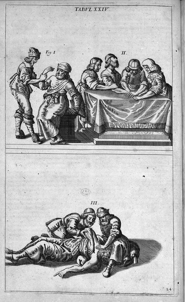An illustration from Cheiroplotheke, seu... Armamentarium chirurgicum XLIII tabulis... exornatum. Opus posthumum..., 1655, leaf 59