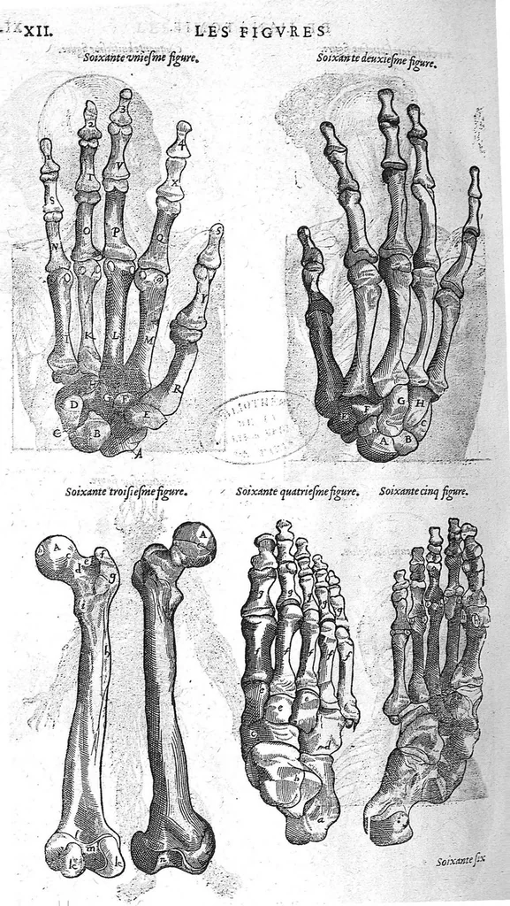 An illustration from Les Oeuvres d’Ambroise Paré, conseiller et premier chirurgien du roy, divisées en vingt-sept livres : avec les figures et portraicts tant de l’Anatomie que des instruments de chirurgie et de plusieurs monstres : reveuz et augmentez par l’autheur pour la seconde Edition, Paris,, 1579, leaf 1250