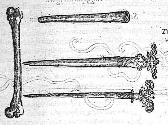 An illustration from Les Oeuvres d’Ambroise Paré, conseiller et premier chirurgien du roy, divisées en vingt-sept livres : avec les figures et portraicts tant de l’Anatomie que des instruments de chirurgie et de plusieurs monstres : reveuz et augmentez par l’autheur pour la seconde Edition, Paris,, 1579, leaf 441