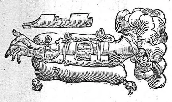 An illustration from Les Oeuvres d’Ambroise Paré, conseiller et premier chirurgien du roy, divisées en vingt-sept livres : avec les figures et portraicts tant de l’Anatomie que des instruments de chirurgie et de plusieurs monstres : reveuz et augmentez par l’autheur pour la seconde Edition, Paris,, 1579, leaf 535