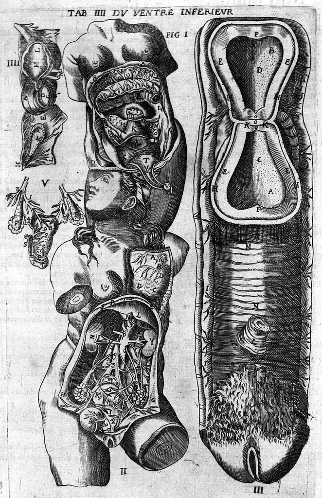 An illustration from Oeuvres de chirurgie, 1649, leaf 141