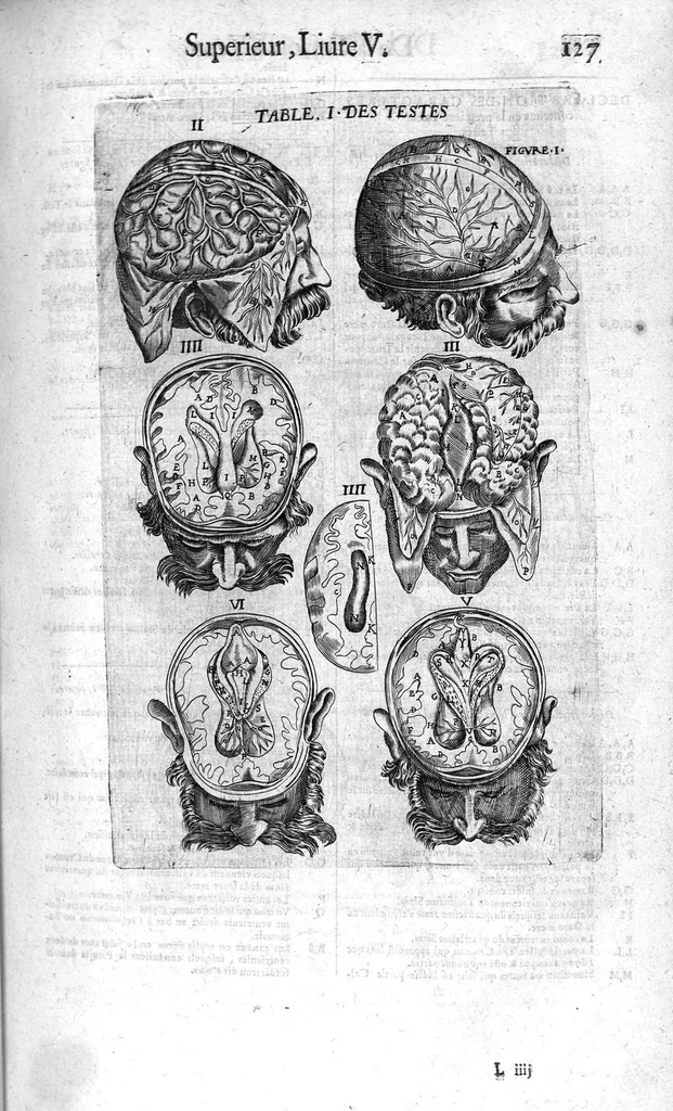 An illustration from Oeuvres de chirurgie, 1649, leaf 178