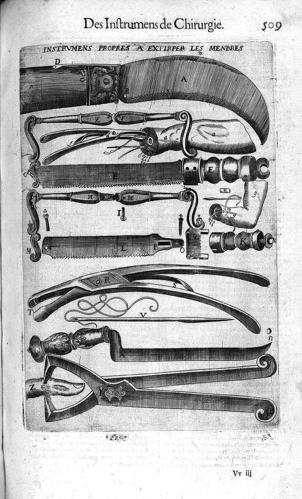 An illustration from Oeuvres de chirurgie, 1649, leaf 592