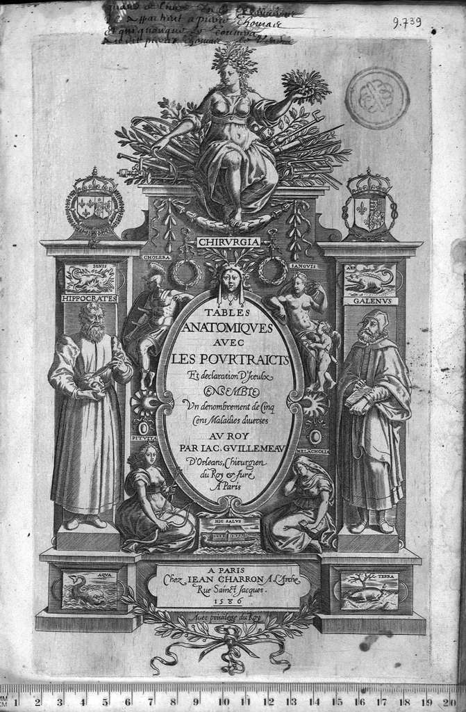 An illustration from Tables anatomiques avec les pourtraicts et declaration d'iceulx ensemble un denombrement de cinq cens maladies diverses, au Roy par Jac. Guillemeau d’Orleans, Chirurgien du Roy et Juré a Paris, [suivi de] Anatomie universelle du corps humain en tables methodiques. Avec les portraicts et figures de chacune des parties et declaration d’icelles. Divisee en sept livres ensemble un denombrement de cinq cens maladies diverses. Au Roy par Jaques Guillemeau, chirurgien du roy, et jure a Paris,, 1586, leaf 0