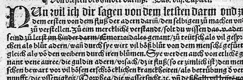 An illustration from Spiegel der Artzney, 1529, leaf 238