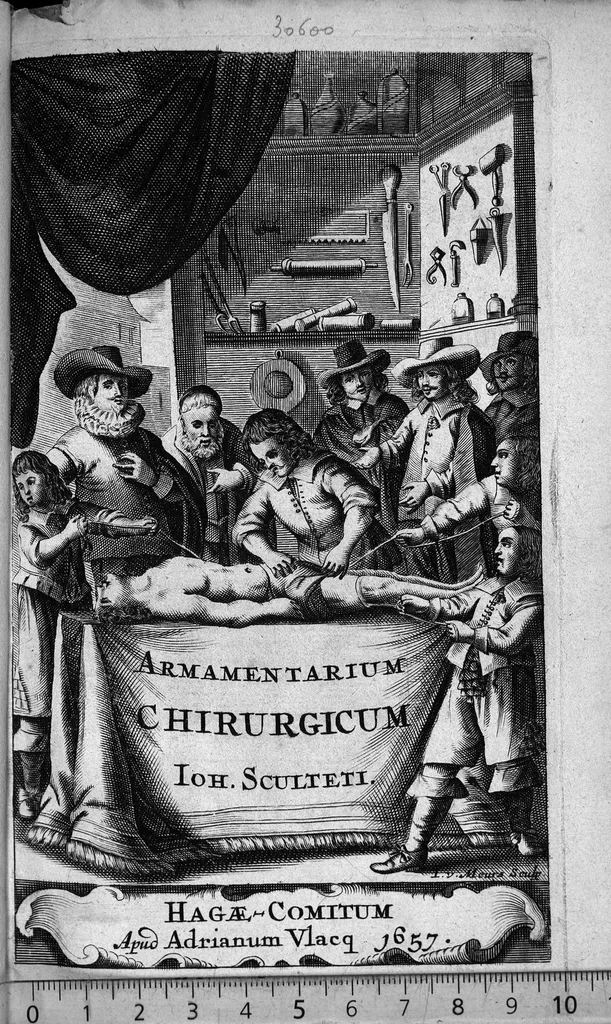 An illustration from Cheiroplotheke, seu... Armamentarium chirurgicum XLIII tabulis... exornatum. Opus posthumum..., 1656, leaf 0