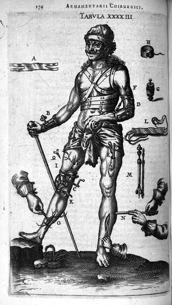 An illustration from Cheiroplotheke, seu... Armamentarium chirurgicum XLIII tabulis... exornatum. Opus posthumum..., 1656, leaf 191