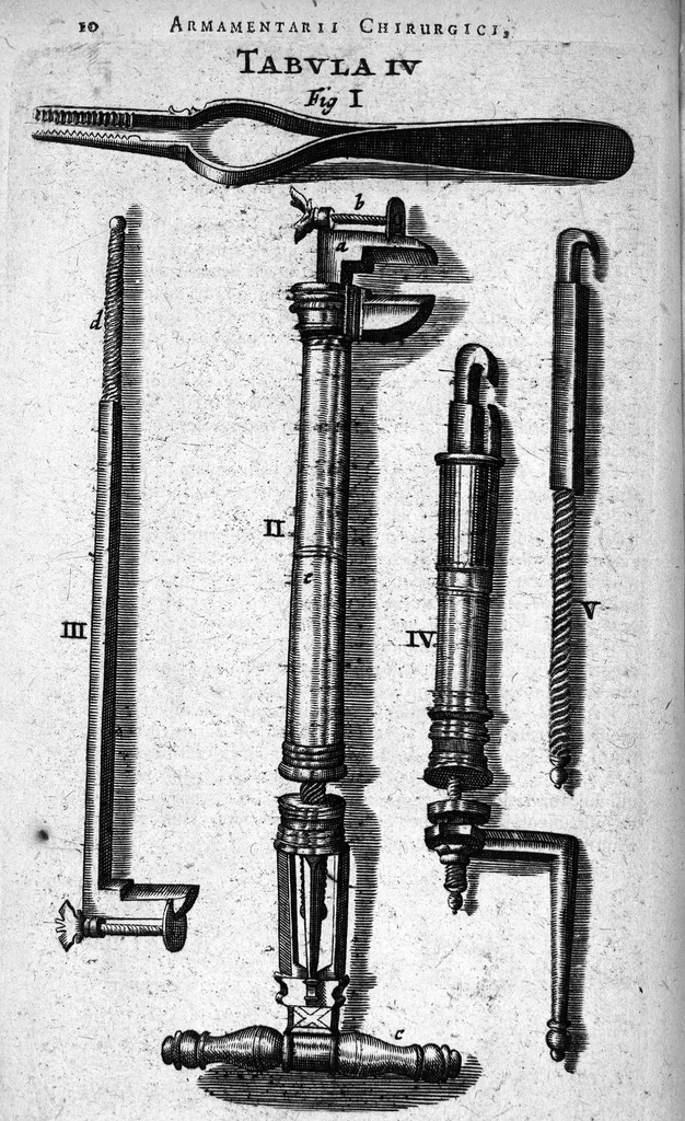 An illustration from Cheiroplotheke, seu... Armamentarium chirurgicum XLIII tabulis... exornatum. Opus posthumum..., 1656, leaf 25