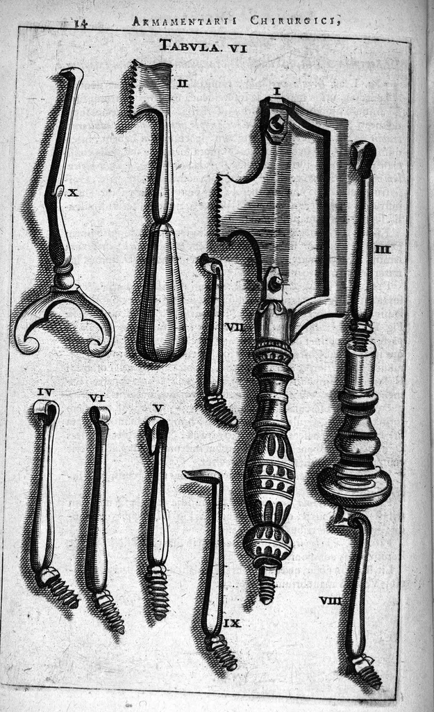 An illustration from Cheiroplotheke, seu... Armamentarium chirurgicum XLIII tabulis... exornatum. Opus posthumum..., 1656, leaf 29