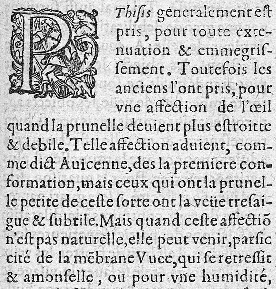 An illustration from Traité des maladies de l'oeil qui sont en nombre de cent treize, ausquelles il est suiect. Par Jacques Guillemeau, natif d’Orleans, chirurgien ordinaire du Roy, et juré à Paris ; A Monsieur Paré, Conseiller du Roy, son premier Chirurgien, 1585, leaf 188