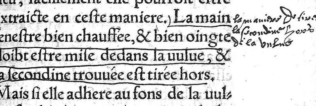 An illustration from La chirurgie de Paulus Aegineta. Qui est le sixiesme livre de ses Oeuvres. Item ung Opuscule de Galien, des tumeurs contre nature. Plus ung Opuscule dudict Galien, de la maniere de curer par abstraction de sang. Le tout traduict de Latin en Françoys par Maistre Pierre Tolet Medecin de l’Hospital de Lyon,, 1540, leaf 240