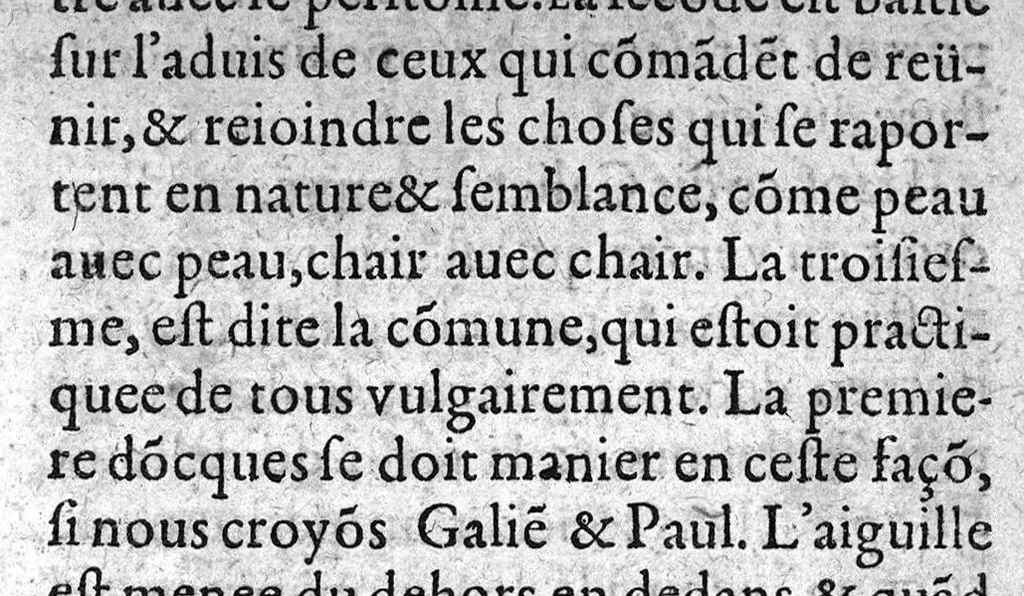 An illustration from Le guide des chirurgiens, fait en latin & redigé en trois livres ...translaté en latin par Germain Courtin..., 1619, leaf 126