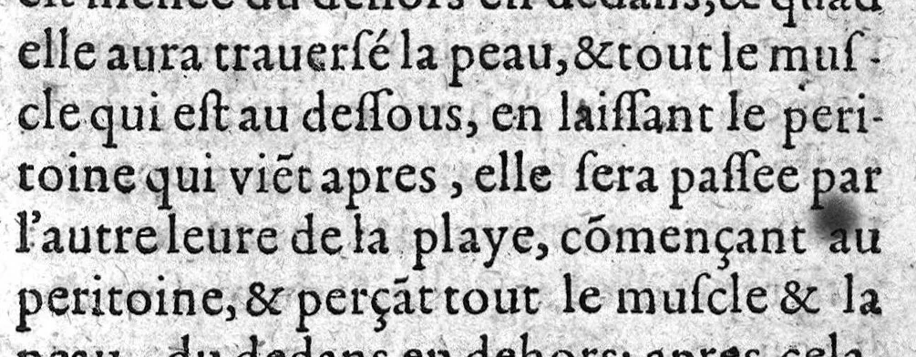 An illustration from Le guide des chirurgiens, fait en latin & redigé en trois livres ...translaté en latin par Germain Courtin..., 1619, leaf 126