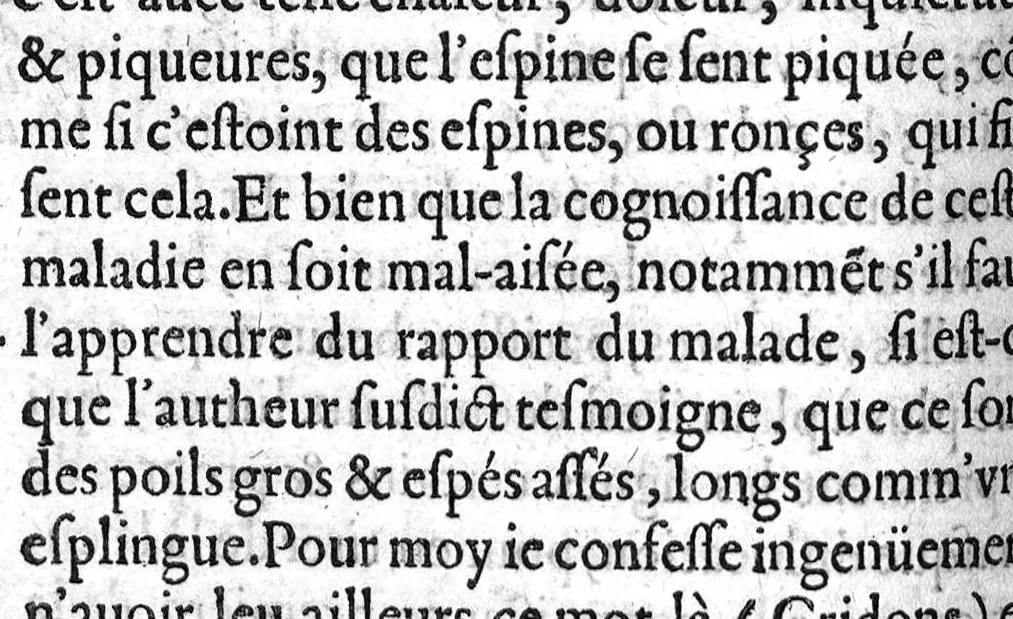 An illustration from Osteologie ou histoire generale des os du corps humain, 1604, leaf 321