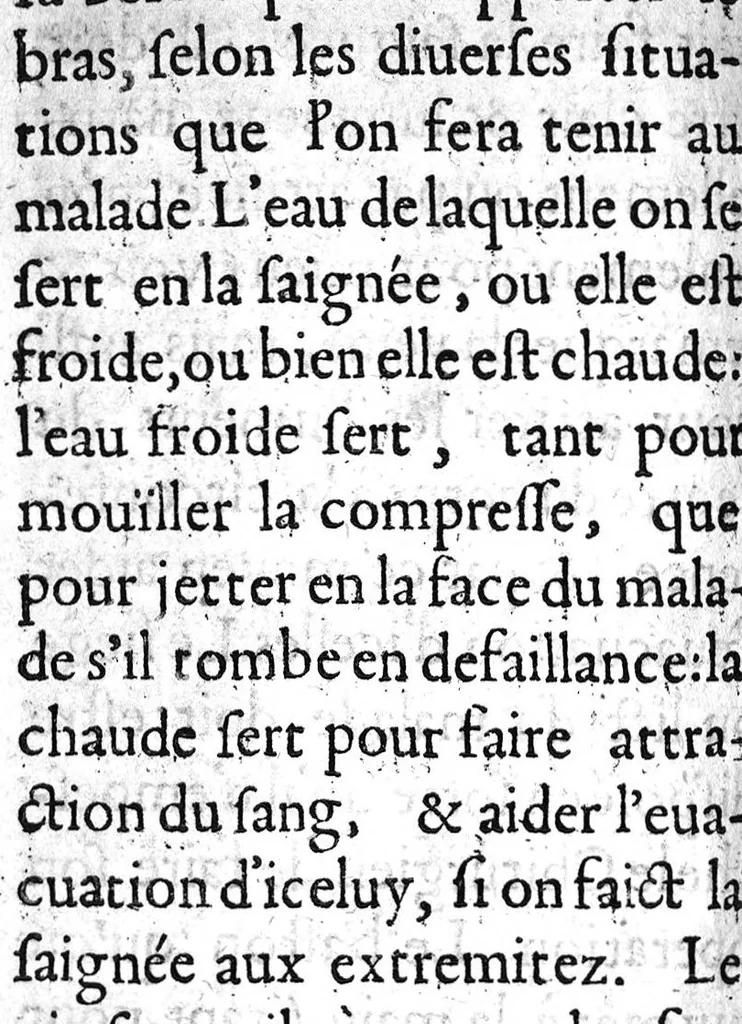 An illustration from Traicté de la phlebotomie. Où selon la doctrine des Anciens & Modernes approuvez, est contenuë la maniere de bien & artificiellement saigner, 1622, leaf 105