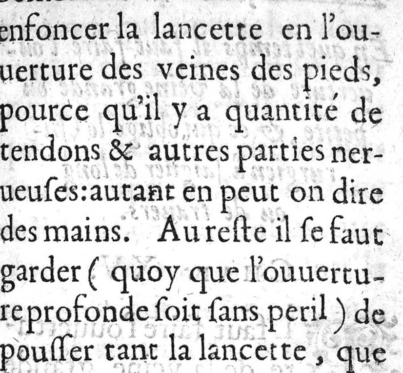 An illustration from Traicté de la phlebotomie. Où selon la doctrine des Anciens & Modernes approuvez, est contenuë la maniere de bien & artificiellement saigner, 1622, leaf 120