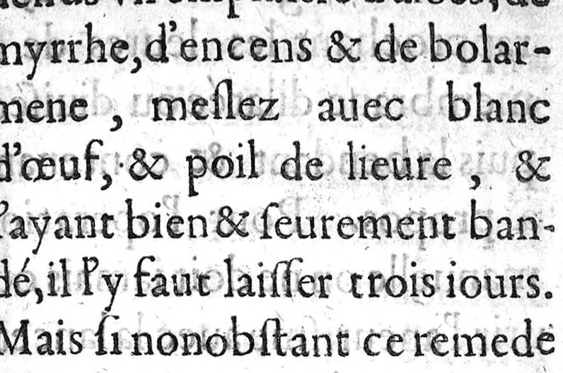 An illustration from Traicté de la phlebotomie. Où selon la doctrine des Anciens & Modernes approuvez, est contenuë la maniere de bien & artificiellement saigner, 1622, leaf 148