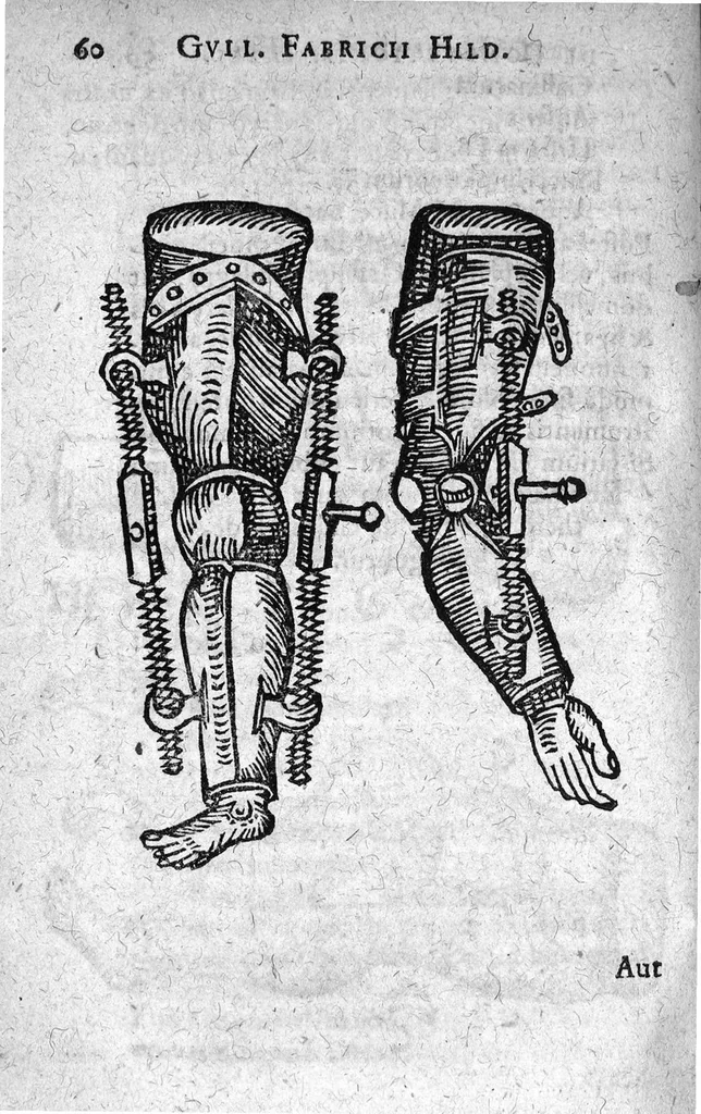 An illustration from De Combustionibus quae oleo et aqua fervida, ferro candente, pulvere tormentario, fulmine ..., 1607, leaf 75