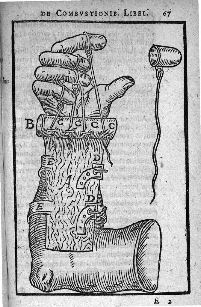 An illustration from De Combustionibus quae oleo et aqua fervida, ferro candente, pulvere tormentario, fulmine ..., 1607, leaf 82