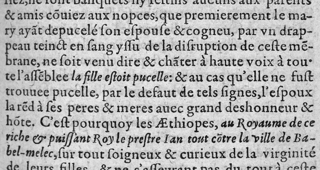 An illustration from Les maladies des femmes & remedes d'ycelles, en trois livres, 1609, leaf 489