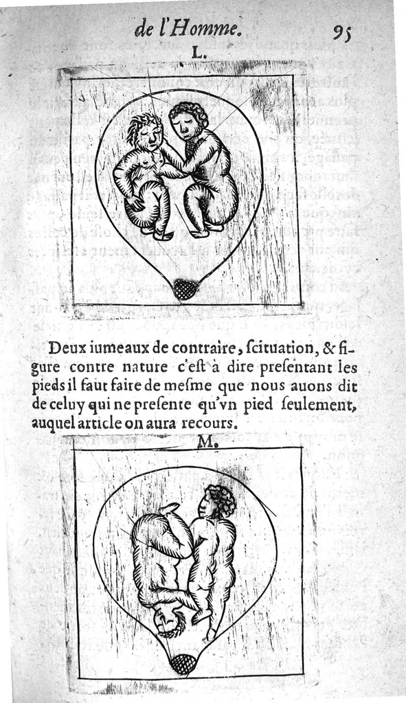 An illustration from Le propagatif de l’homme et secours des femmes en travail d’enfant,utiles & necessaire à toutes personnes. Enrichy de figures, 1623, leaf 106