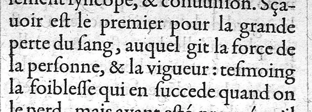 An illustration from Traitte nouveau de l’Hysterotomotokie,ou Enfantement Caesarien. Qui est Extraction de l’enfant par incision laterale du ventre, et matrice de la femme grosse ne pouvant autrement accoucher. Et ce sans prejudicier à la vie de l’un, ny de l’autre ; ny empescher la fœcondité maternelle par après. Par Françoys Rousset Medecin,, 1581, leaf 172