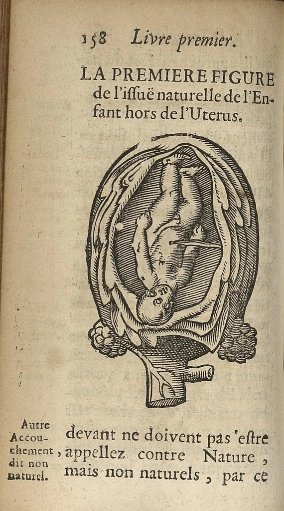 An illustration from L'accoucheur methodique, qui enseigne la maniere d'operer dans tous les accouchements naturels et artificiels..., 1676, leaf 189