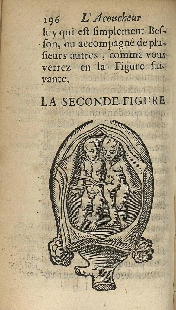 An illustration from L'accoucheur methodique, qui enseigne la maniere d'operer dans tous les accouchements naturels et artificiels..., 1676, leaf 227