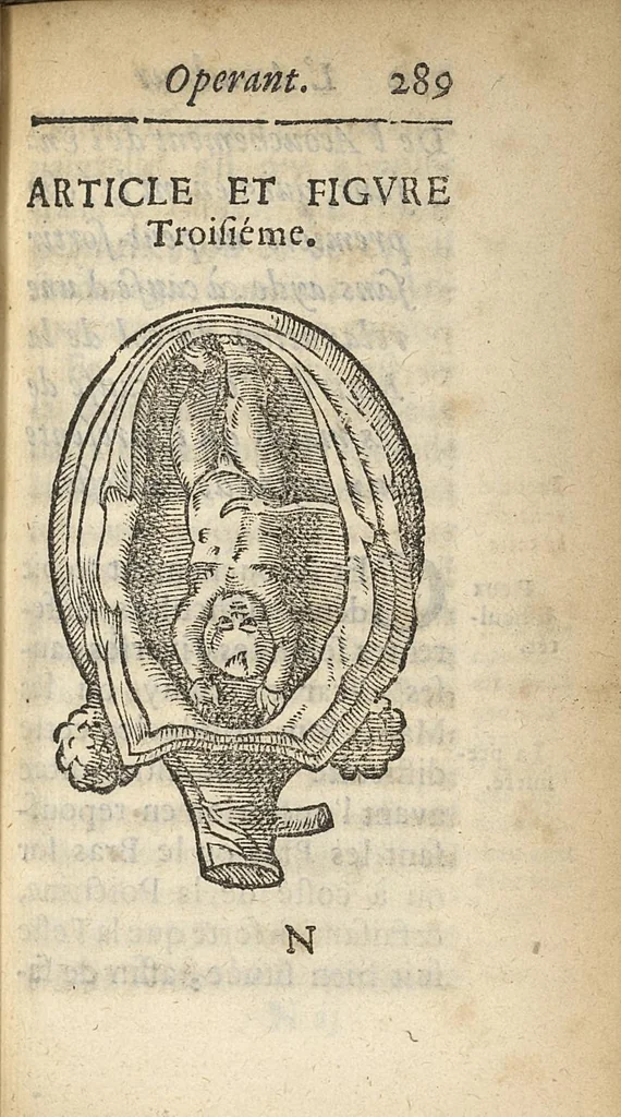 An illustration from L'accoucheur methodique, qui enseigne la maniere d'operer dans tous les accouchements naturels et artificiels..., 1676, leaf 320