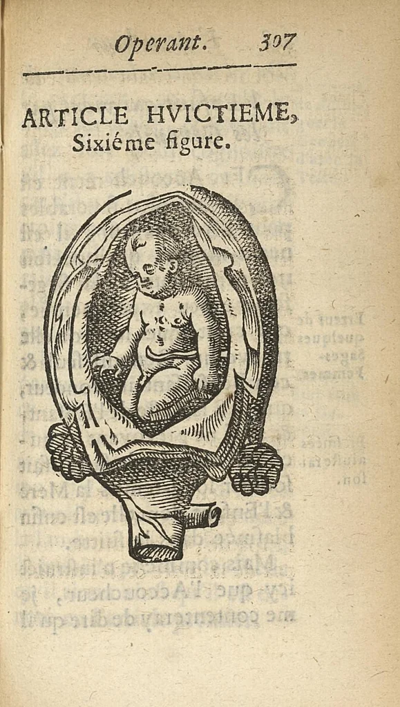 An illustration from L'accoucheur methodique, qui enseigne la maniere d'operer dans tous les accouchements naturels et artificiels..., 1676, leaf 338