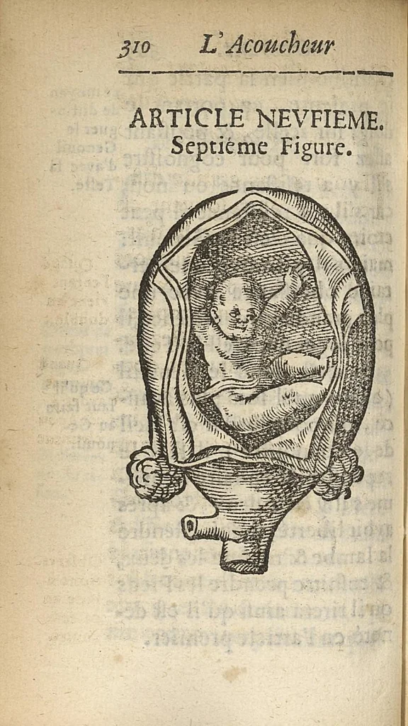 An illustration from L'accoucheur methodique, qui enseigne la maniere d'operer dans tous les accouchements naturels et artificiels..., 1676, leaf 341