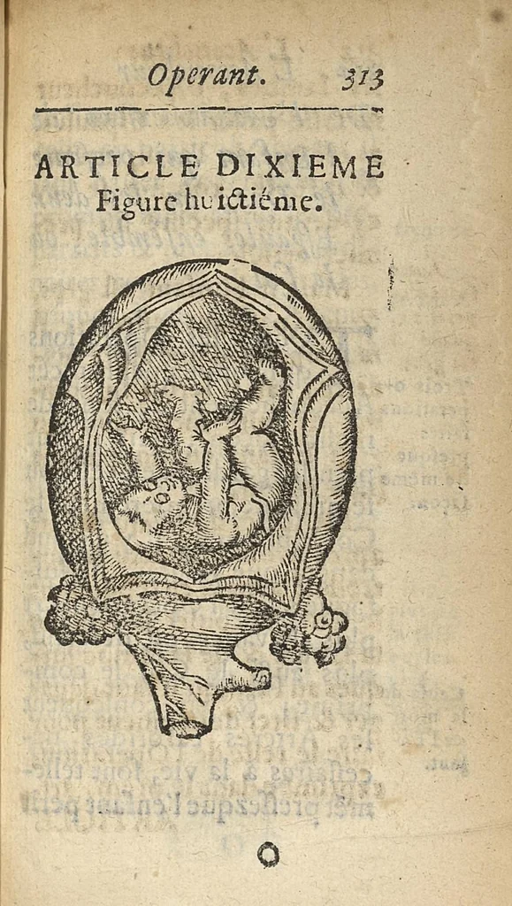 An illustration from L'accoucheur methodique, qui enseigne la maniere d'operer dans tous les accouchements naturels et artificiels..., 1676, leaf 344